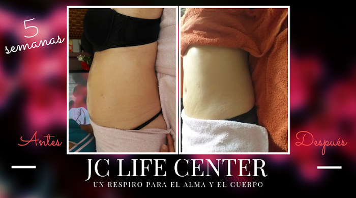 Imagen del Slider