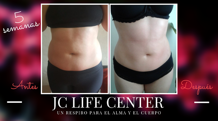 Imagen del Slider