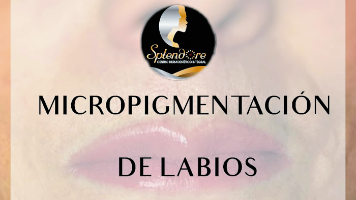 Imagen del Slider