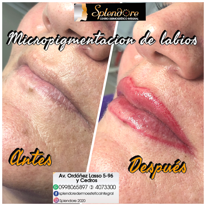 Imagen del Slider