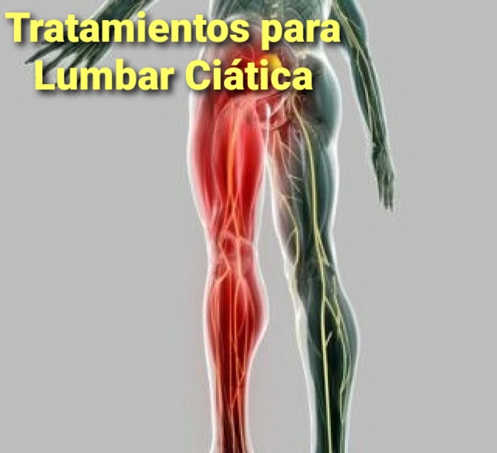 Imagen del Slider