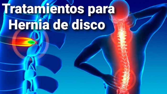 Imagen del Slider