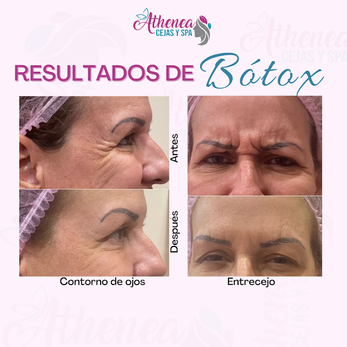 Imagen del Slider