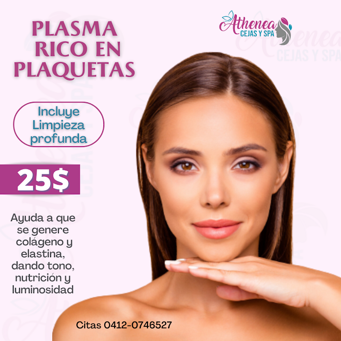 Imagen del Slider