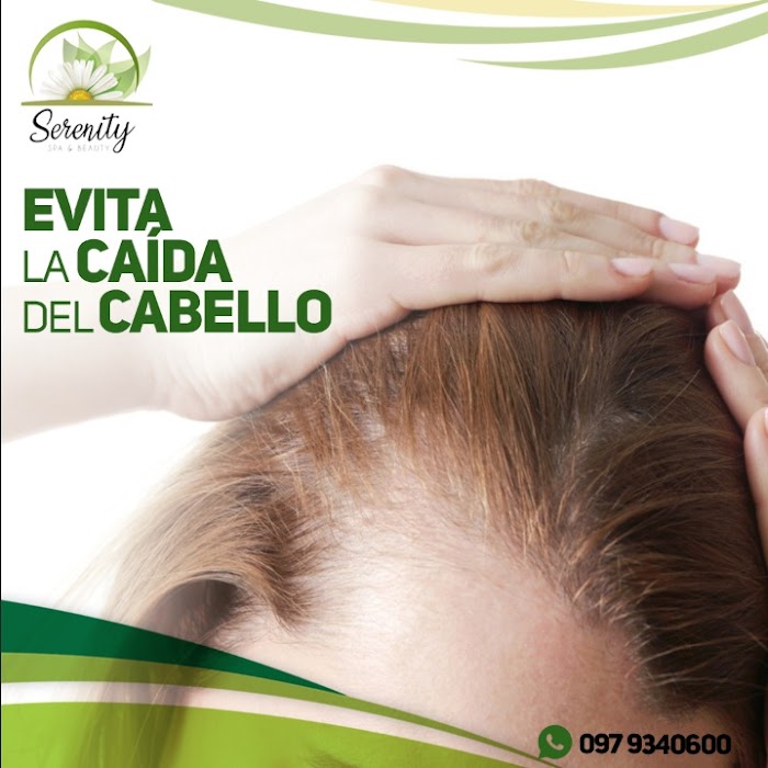 Imagen del Slider