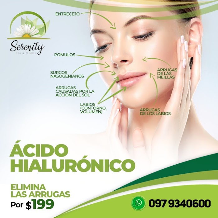 Imagen del Slider