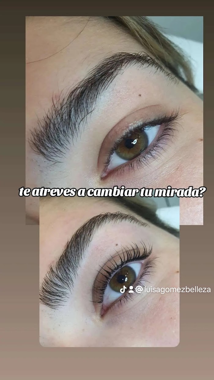 Imagen del Slider