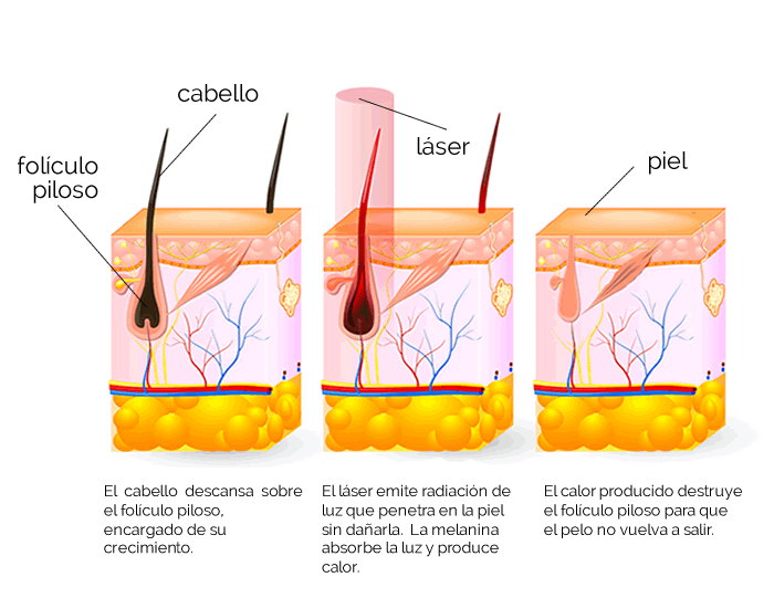 Imagen del Slider