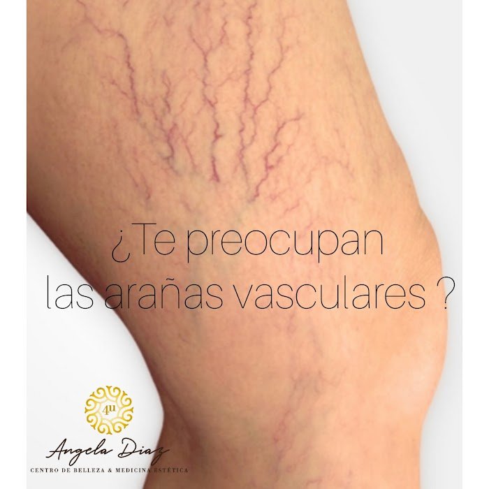 Imagen del Slider