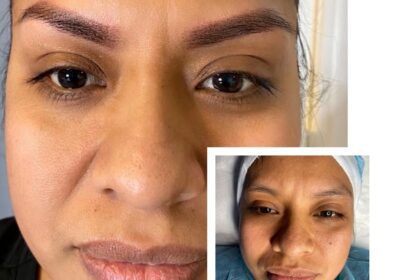 Lili Ruiz Estética Avanzada