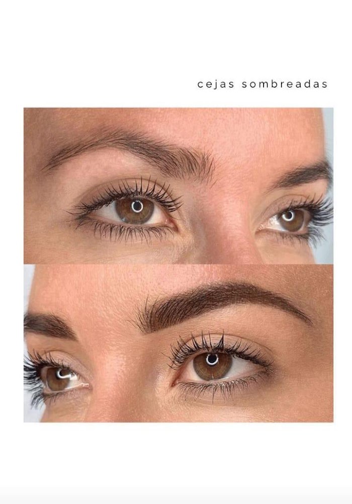 Imagen del Slider