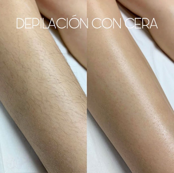 Imagen del Slider