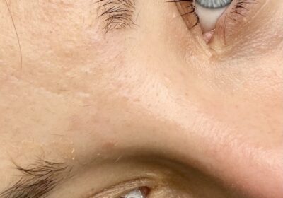 Estètica PrettySoul