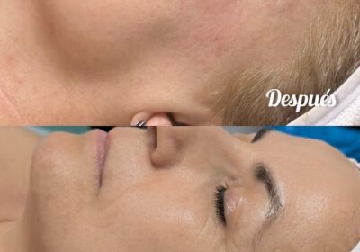 Miriam Perellon Estética avanzada