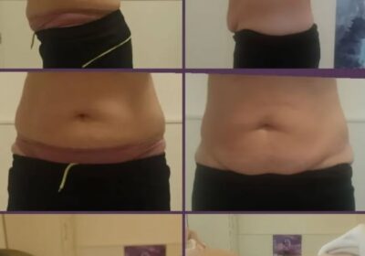 QUIROMASAJISTA ANTONIO GONZÁLEZ