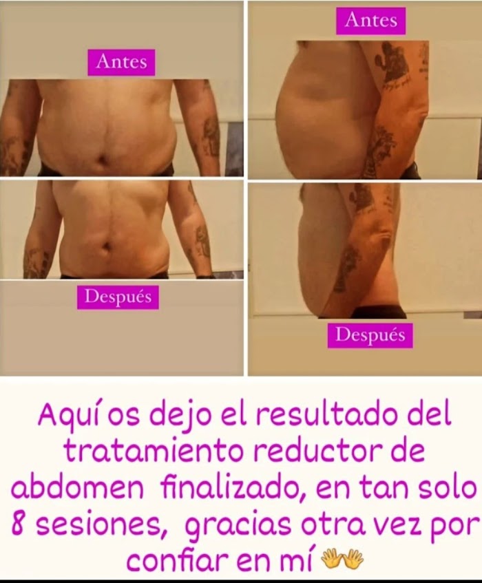 Imagen del Slider