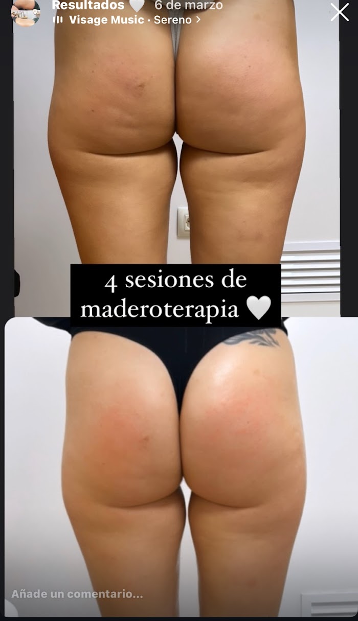 Imagen del Slider