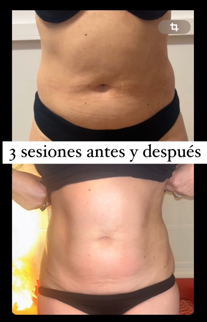 Imagen del Slider