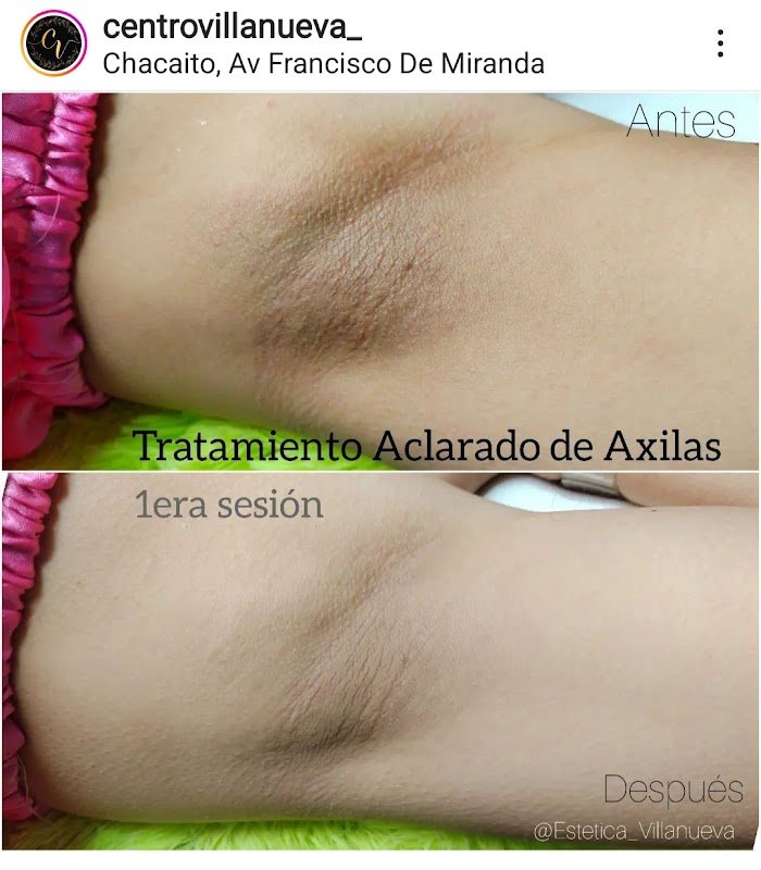 Imagen del Slider