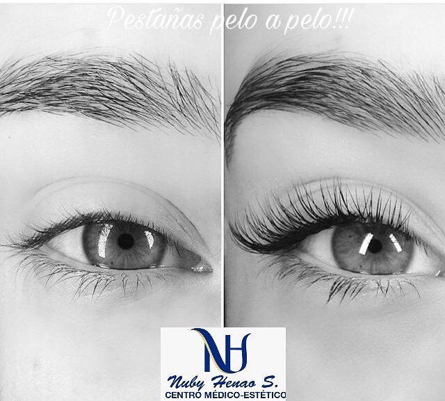 Imagen del Slider