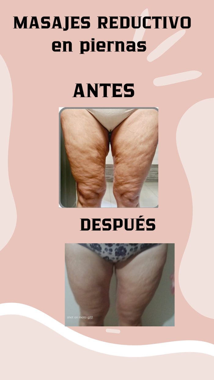 Imagen del Slider