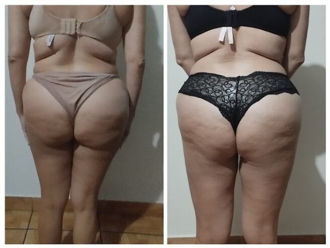 Masajes Raquel Lázaro