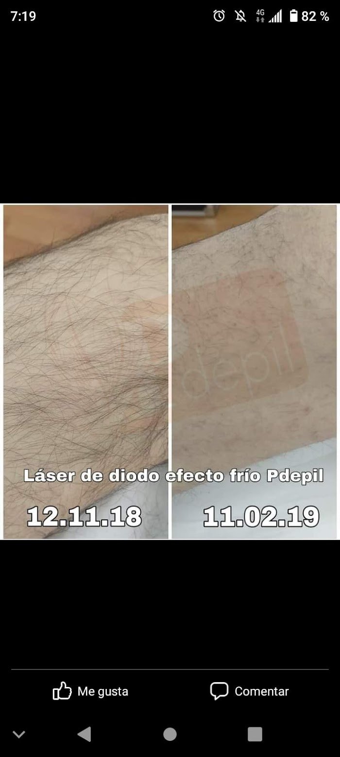 Imagen del Slider