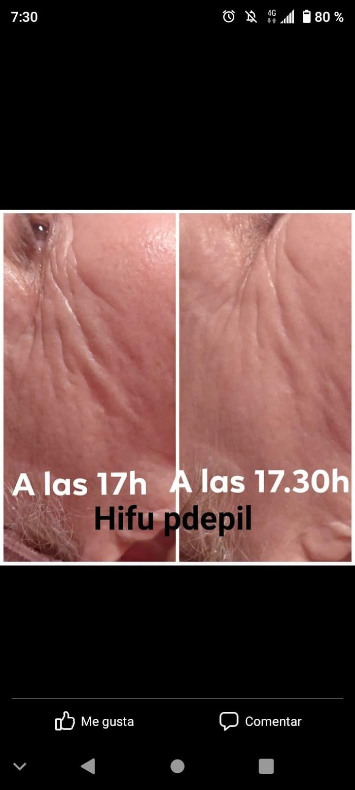 Imagen del Slider