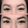 Simetría | Estética y Belleza