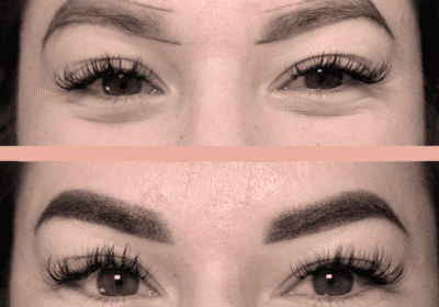 Simetría | Estética y Belleza