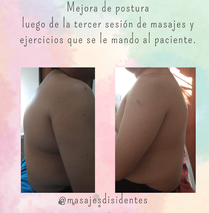 Imagen del Slider