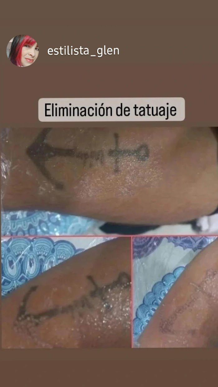 Imagen del Slider