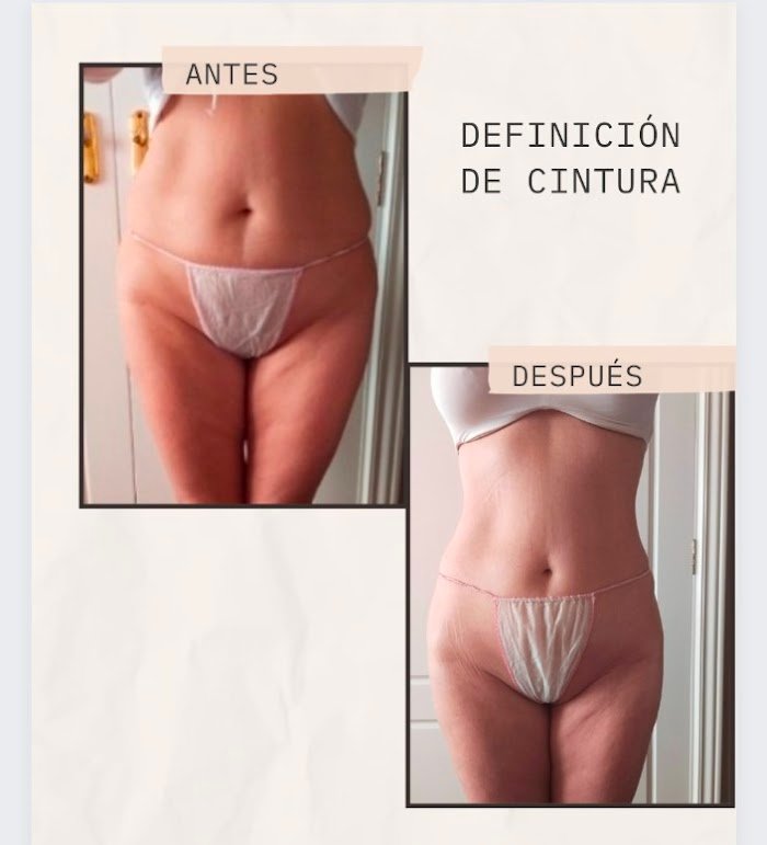 Imagen del Slider