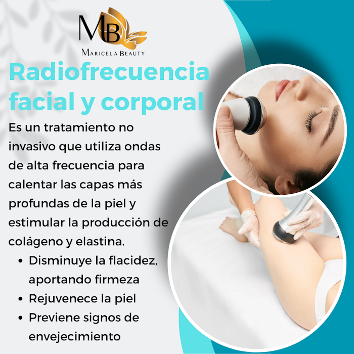 Imagen del Slider