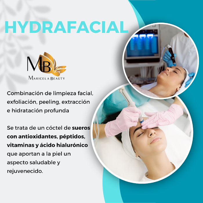 Imagen del Slider