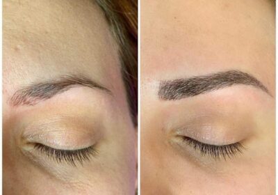 Quiroesteti By Salud