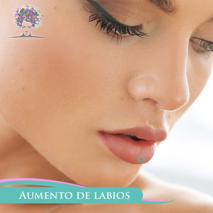 Imagen del Slider