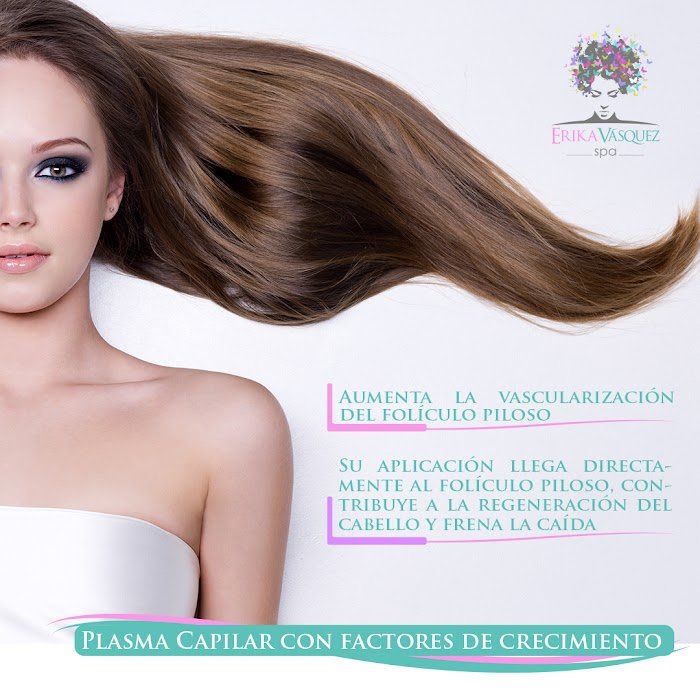 Imagen del Slider