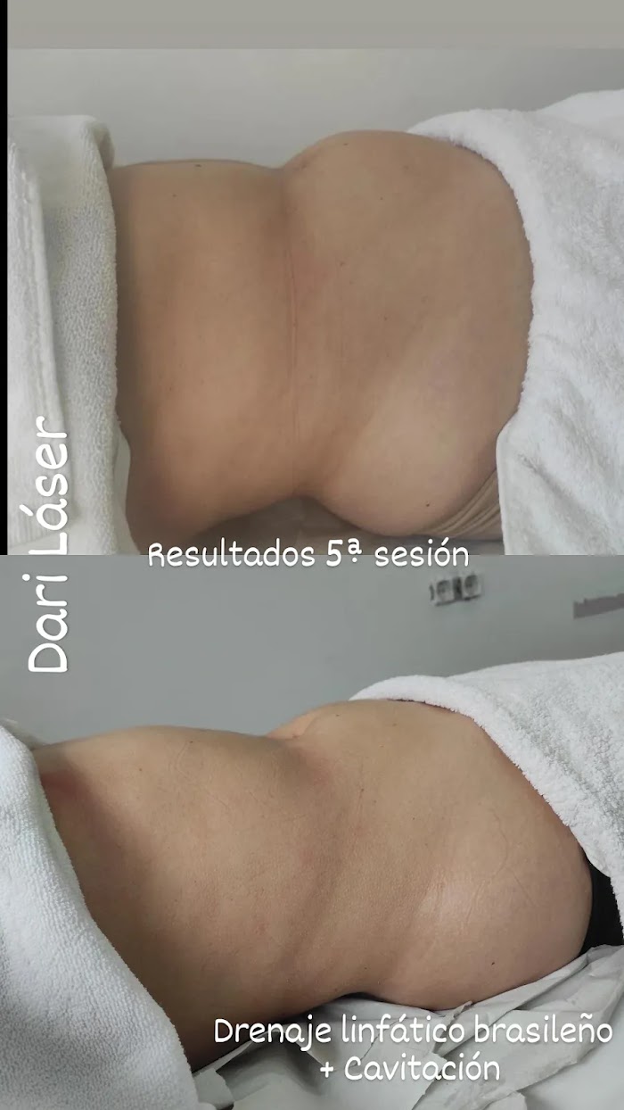 Imagen del Slider