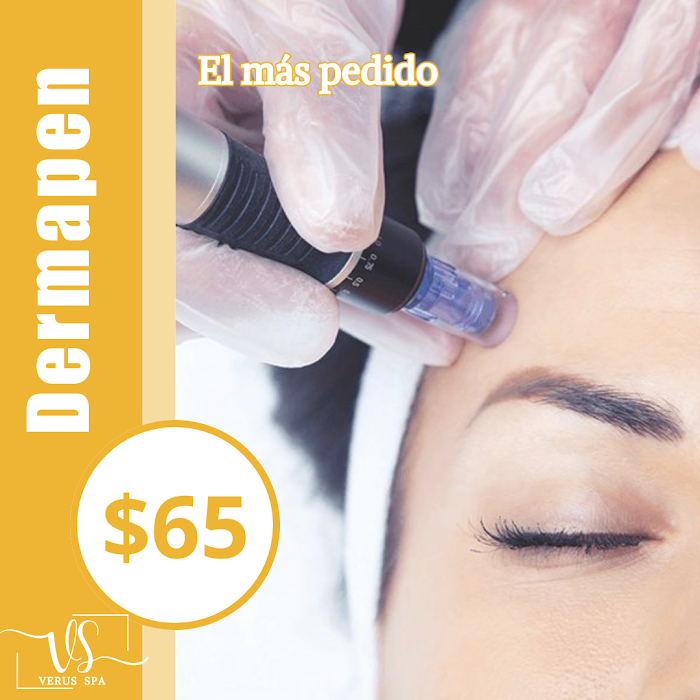 Imagen del Slider
