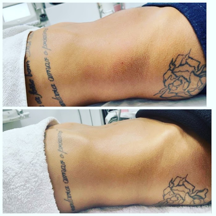 Katy estética 5 1740544991 933 photo Katy estética