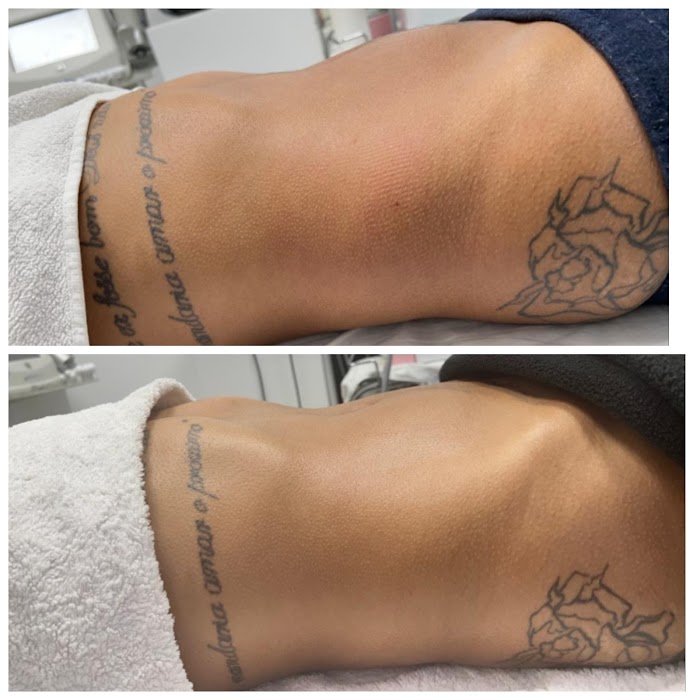 Katy estética 7 1740544993 533 photo Katy estética