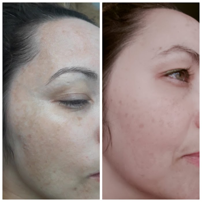 Katy estética 8 1740544993 639 photo Katy estética