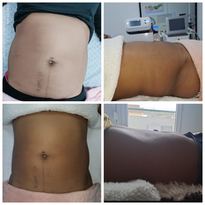 Katy estética 9 1740544994 800 photo Katy estética