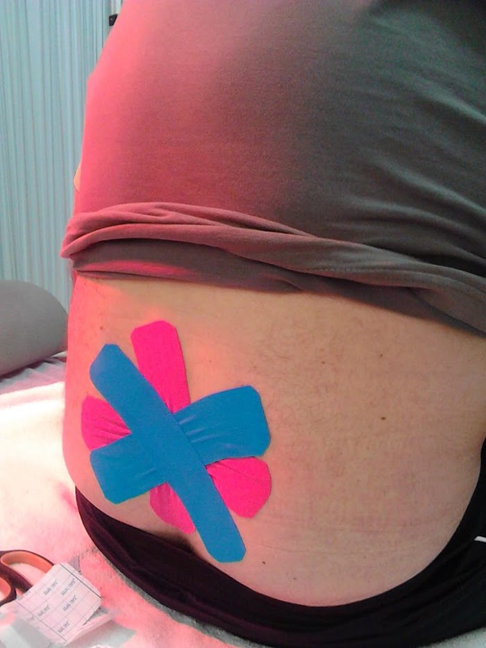 1740558693 815 photo Albafisio