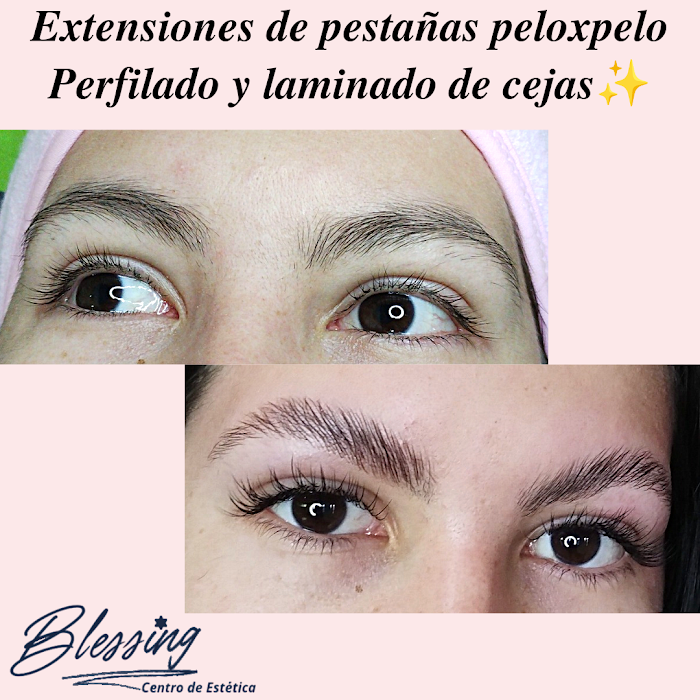 1740658602 397 Blessing Centro de Estetica Blessing Centro de Estética