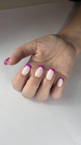 Chesscanails