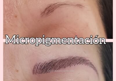 Estética Avanzada Sofía