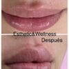 Esthetic & Wellness