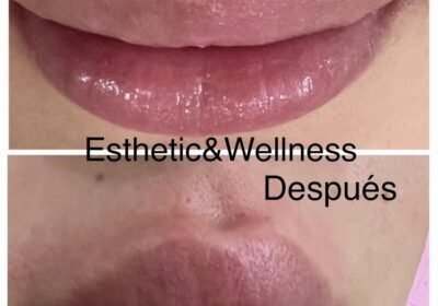 Esthetic & Wellness